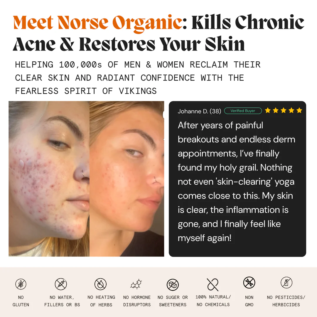 Complete Gut Repair & Hormonal Balance System for Female Acne - Image 3
