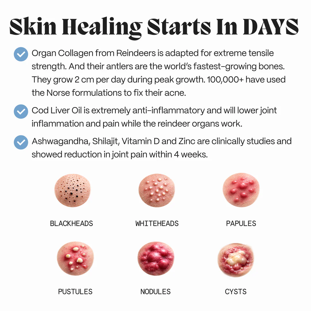 Complete Gut Repair & Hormonal Balance System for Male Acne - Image 13