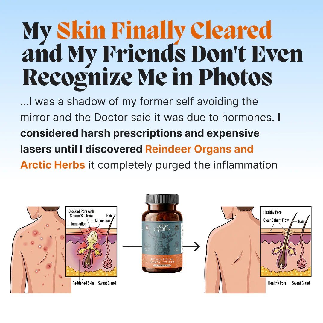 Complete Gut Repair & Hormonal Balance System for Male Acne - Image 18